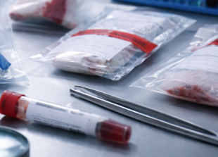 Archive picture of 'evidence' or forensics.